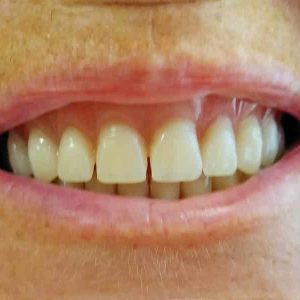 Beli vizil Zubar Zarkovo Moj Stomatolog Sandra Marinkovic Visnjic Ordinacija LenaV