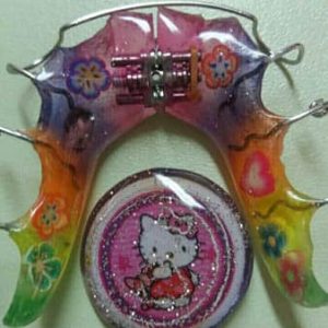 Mobilne proteze Zubar Zarkovo Moj Stomatolog Sandra Marinkovic Visnjic Ordinacija LenaV3