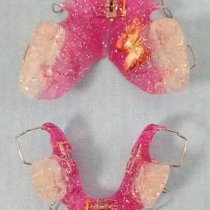 Mobilne proteze Zubar Zarkovo Moj Stomatolog Sandra Marinkovic Visnjic Ordinacija LenaV4