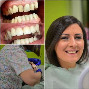 Nasi radovi Stomatolog Zarkovo - 001