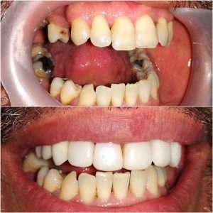 Nasi radovi Stomatolog Zarkovo - 002