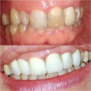 Nasi radovi Stomatolog Zarkovo - 005