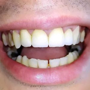 Nasi radovi Stomatolog Zarkovo - 006