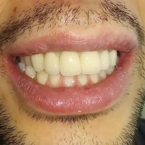 Nasi radovi Stomatolog Zarkovo - 007