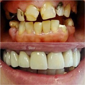 Nasi radovi Stomatolog Zarkovo - 008