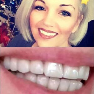 Nasi radovi Stomatolog Zarkovo - 009