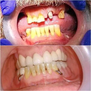 Nasi radovi Stomatolog Zarkovo - 010