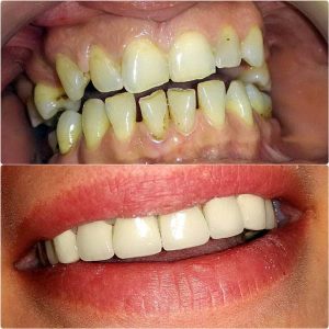 Nasi radovi Stomatolog Zarkovo - 011