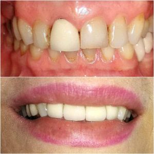 Nasi radovi Stomatolog Zarkovo - 013