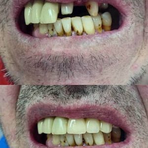 Nasi radovi Stomatolog Zarkovo - 014