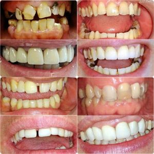 Nasi radovi Stomatolog Zarkovo - 017