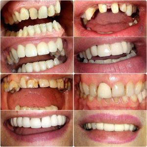 Nasi radovi Stomatolog Zarkovo - 018